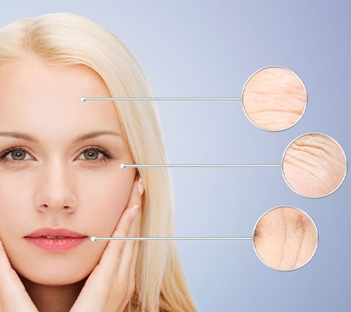 ست لیفت اکتیو ضدلک و ضدچروک ویشی